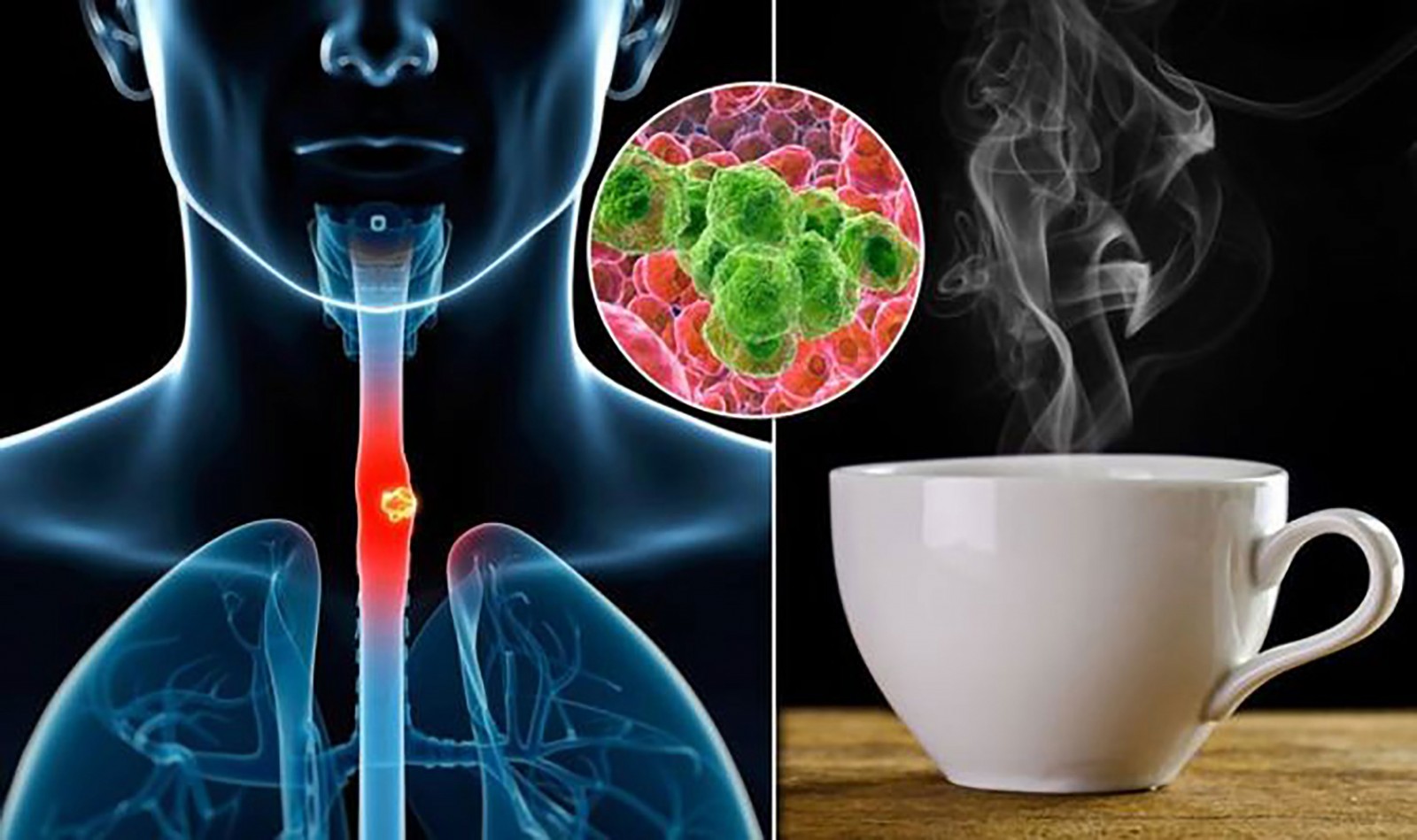Uống trà quá nóng dễ gây tổn thương niêm mạc bên trong thực quản và cổ họng, làm tăng nguy cơ mắc ung thư thực quản. Ảnh: Daily Express