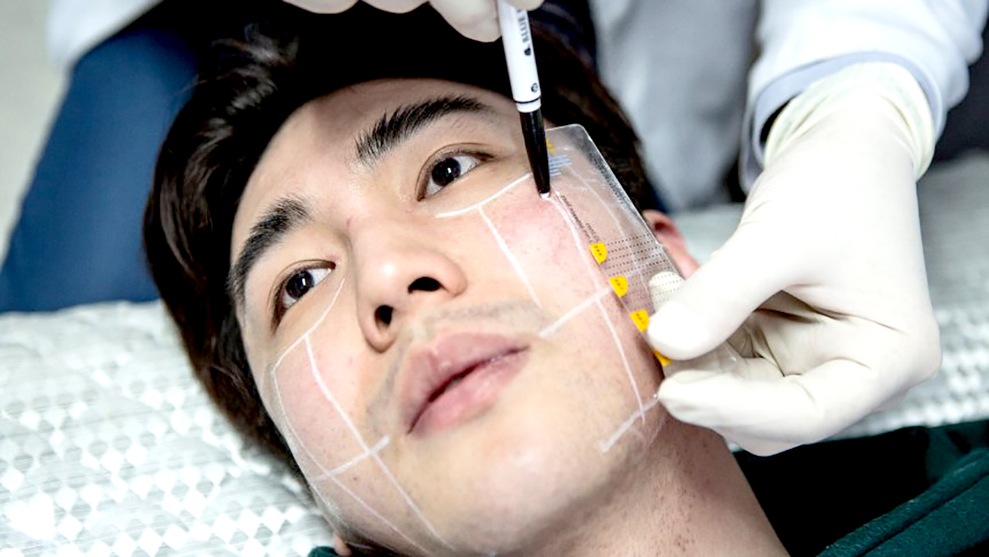 Một nam giới Hàn Quốc chuẩn bị phẫu thuật thẩm mỹ. Ảnh: Spiegel