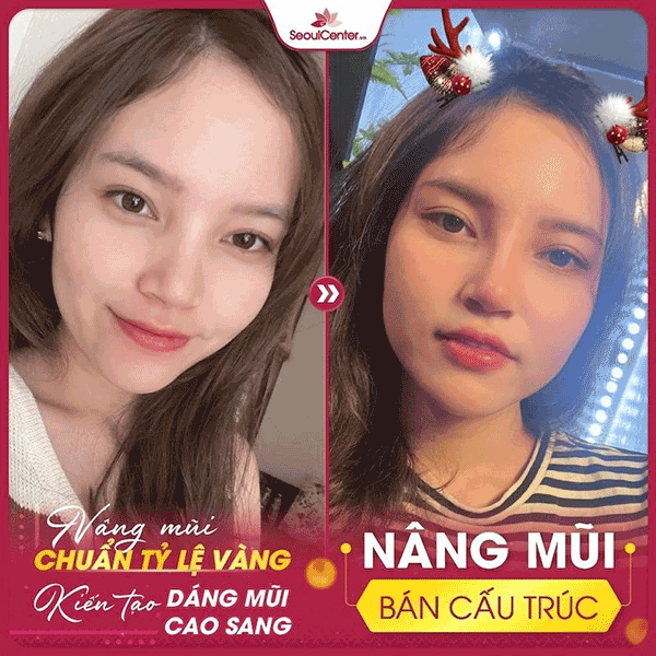 Tân trang nhan sắc đón tài lộc trong năm mới 2022