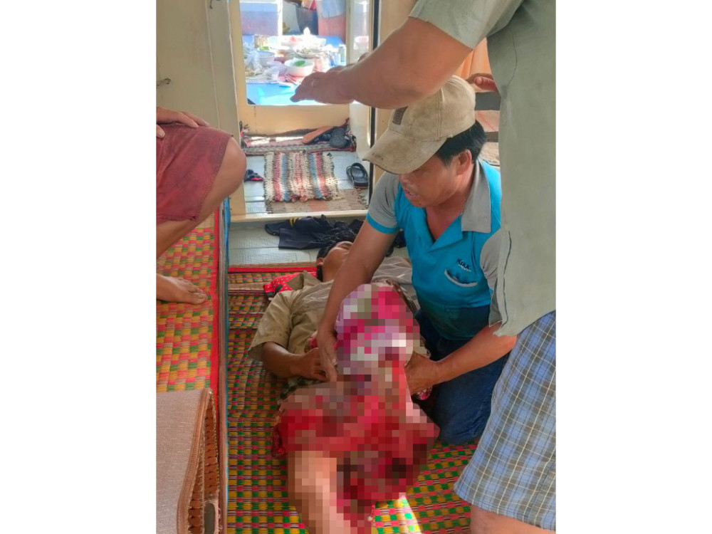 Cà Mau: Kịp thời cứu giúp ngư dân bị tai nạn mất bàn chân Ngư dân bị thương hiện sức khỏe đã ổn định.