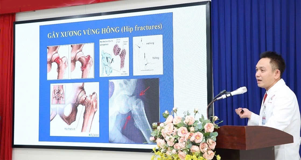 Ngừa nguy cơ khiến phụ nữ mãn kinh bị gãy xương