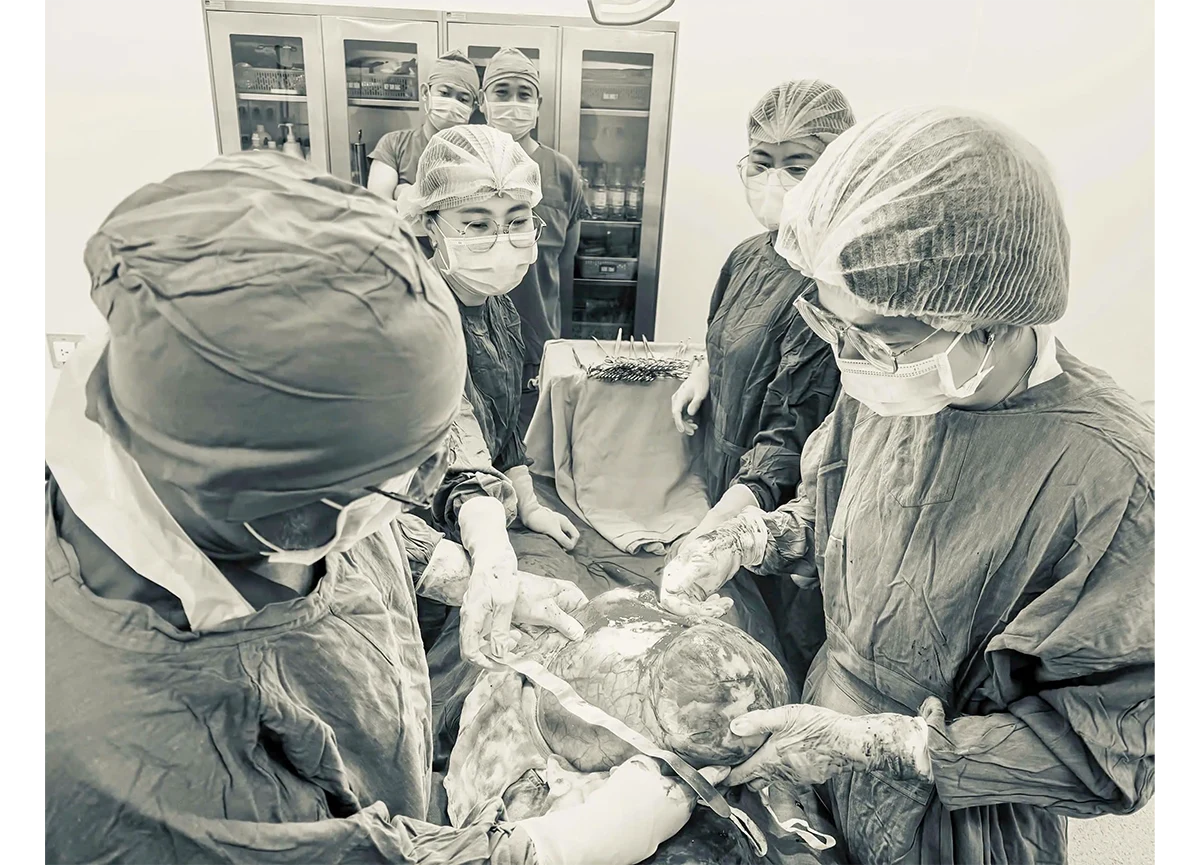 Bác sĩ sản khoa Cần Thơ mổ thành công 2 ca u xơ tử cung lấn hết ổ bụng