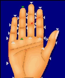 Có thể dự đoán viêm khớp qua ngón tay