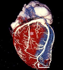 Hồi sinh quả tim đã chết