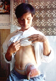 "Tôi muốn được sống và làm việc như mọi người..."