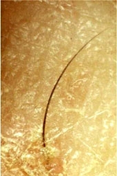 “Sức mạnh” của sợi tóc