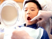 Răng hư không cần trám