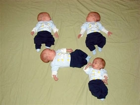 Một ca sinh 4 hiếm thấy