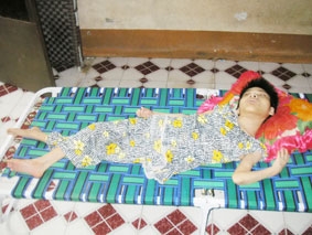 30 năm với nỗi đau da cam