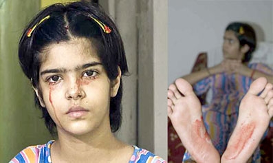 Bỗng dưng chảy máu qua da