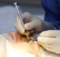 Tiêm gien vào võng mạc có thể chữa mù mắt