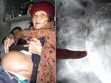 “Mang thai” 60 năm