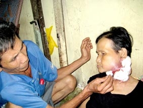 Bà Lan cần tiền điều trị bệnh hiểm nghèo!