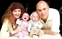 Sinh đôi lúc “thập tử nhất sinh”