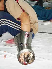 Cảnh báo gia tăng tai nạn lao động
