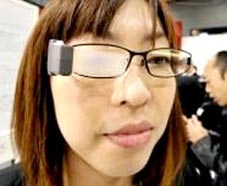 Mắt kính 
“tạo nước mắt”