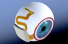 50 phát minh đặc sắc nhất năm 2009
<div align=right><font size=1>(Tiếp theo kỳ trước)</font></div>