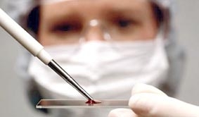 Triển vọng chữa nhồi máu cơ tim bằng tế bào gốc