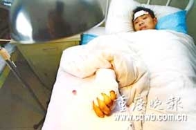 Tay phải là tay trái