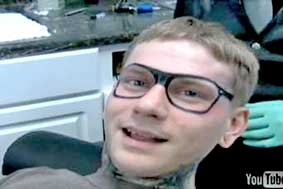 Cặp kính không thể tháo ra