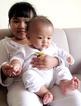 Em bé có tay chân 
đều 6 ngón