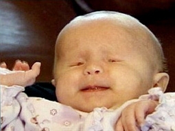 Siêu âm không thể 
phát hiện tật khuyết mắt