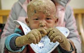 Cậu bé người cá