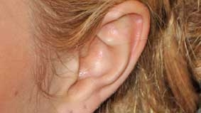 Cái giá của từ “mập”