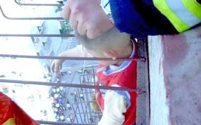 Thoát chết nhờ... lỗ tai