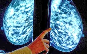 Thử nghiệm vắc-xin ngừa ung thư vú