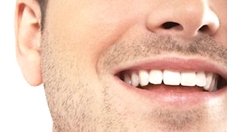 Có thể phục hồi răng sâu bằng gel