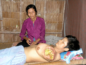 Bệnh tật đang hành hạ anh Vinh