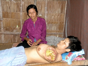 Bệnh tật đang hành hạ anh Vinh