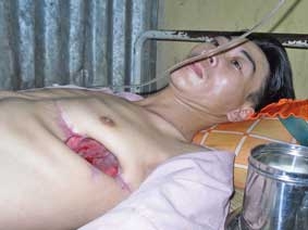 Anh Danh Hiếu đã kiệt sức với bệnh tật !