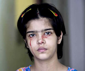 Bí ẩn cô gái không ngừng chảy máu