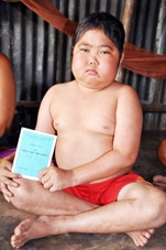 Em Phú mang bệnh hiểm nghèo, cần được giúp đỡ