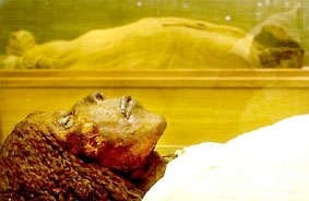 Ung thư  bệnh của thời đại 
và “hoàn toàn nhân tạo”