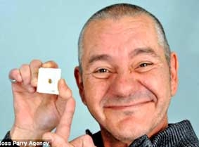 Chiếc răng mắc kẹt 33 năm trong  lỗ tai