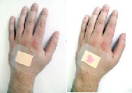 Băng dán vết thương đổi màu