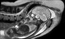 Chụp ảnh MRI lúc em bé chào đời