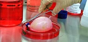 Ghép cơ quan nhân tạo