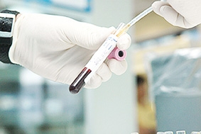 Xét nghiệm máu có thể 
chẩn đoán ung thư