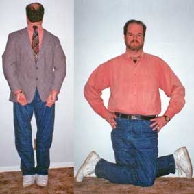 Người dẻo như cao su