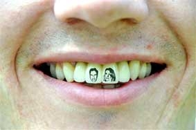 Xăm răng mừng đám cưới hoàng gia