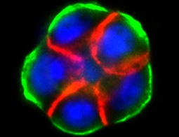 Phát hiện protein chống ung thư vú