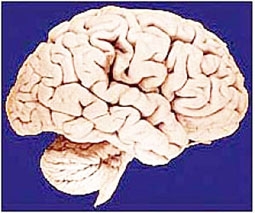 Não người nhân tạo