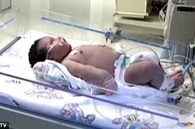 Bé sơ sinh nặng 7,3 kg