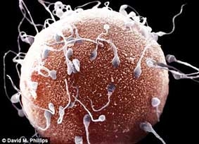 1/4 đàn ông trên thế giới khó có con vì lỗi gien