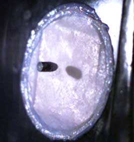 Da người có thể chống đạn?