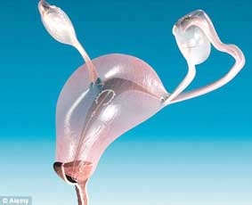 Vòng tránh thai giúp giảm nguy cơ ung thư cổ tử cung